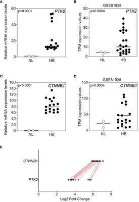 Focal adhesion kinase and its epigenetic interactors as diagnostic and therapeutic hints for pediatric hepatoblastoma